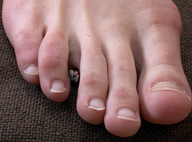 collage feet barefoot unknown_artist shrunken_man between_toes pinned under_foot