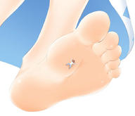 giantess feet toes barefoot soles touhou shrunken_men cirno point_of_view stuck_to_foot