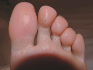 crush collage micro feet blood sweat close_up