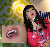 collage vore black_hair mouth teeth shrunken_men black_eyes entrapment inside_mouth lipstick singer malaygiantess