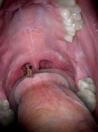 collage vore tongue penis sitting blowjob shrunken_man throat inside_mouth on_penis