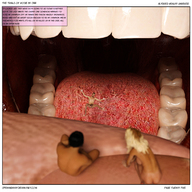 micro vore tongue mouth red_hair shrunken_men fighting shrunken_people shrunken_woman throat trapped tinies digital_render openhighhat altered_reality_world the_trials_of_rosie micromants