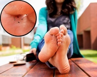collage micro barefoot blood sandals unaware shrunken_people between_toes zoom mrderpington footmodeling503