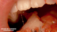 crush micro vore city tongue destruction lips giantess_katelyn food advertisement movie shrunken_city garden_of_a_giantess